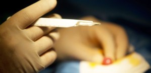 Zirkumzision ist der vermutlich häufigste Eingriff weltweit. © Kay Nietfeld /dpa