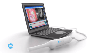 Aerzte-koennen-mit-der-mobilen-Sonde-Bilder-des-Gebaermutterhalses-schiessen_image_width_560